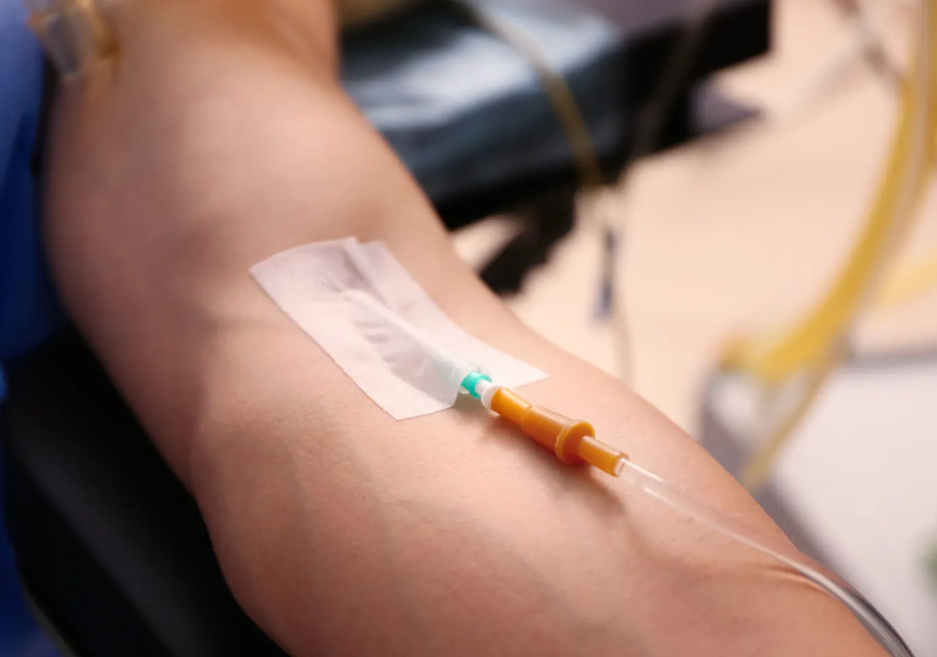 Kroplówki witaminowe Kołobrzeg: przedramię z kaniulą i przezroczystym opatrunkiem